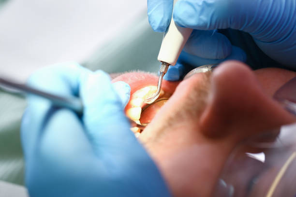 Best Emergency Dentist for Knocked-Out Tooth in Nicholson, MS