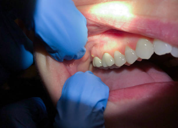 Best 24-Hour Emergency Dentist in Nicholson, MS