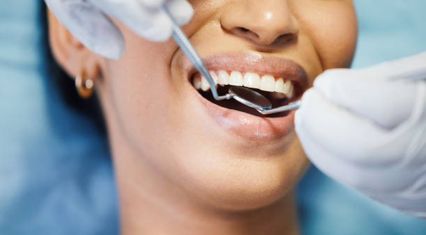 Best Emergency Dentist for Special Needs Patients in Nicholson, MS